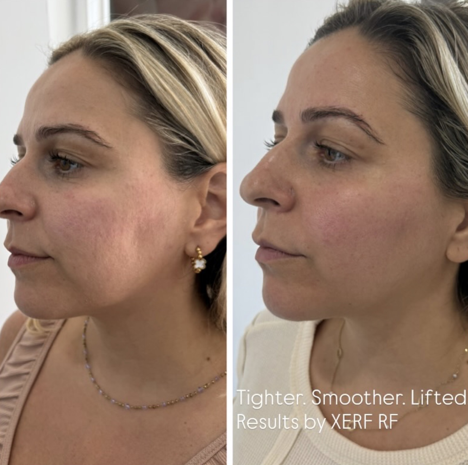 Spa treatment image